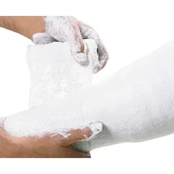 Gipsverband Cellona afzonderlijk in aluminiumfolie | 6 cm x 2 m